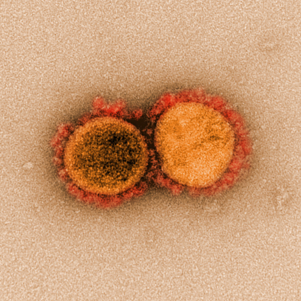 Two SARS-CoV-2 viruses, smooching 